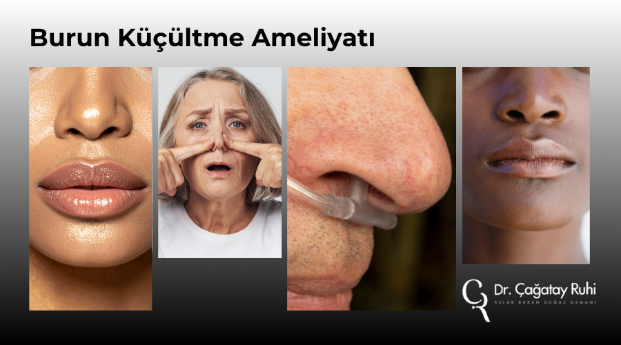 Burun küçültme ameliyatı nedir, nasıl yapılır?  - İstanbul