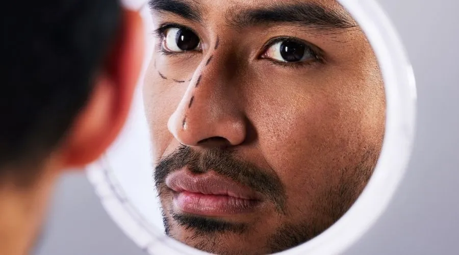 Erkeklerde Revizyon Burun Estetiği | İstanbul KBB