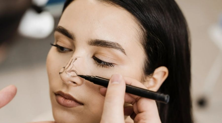 Revizyon Rinoplastiyi Aynı Doktor mu Yapmalı?