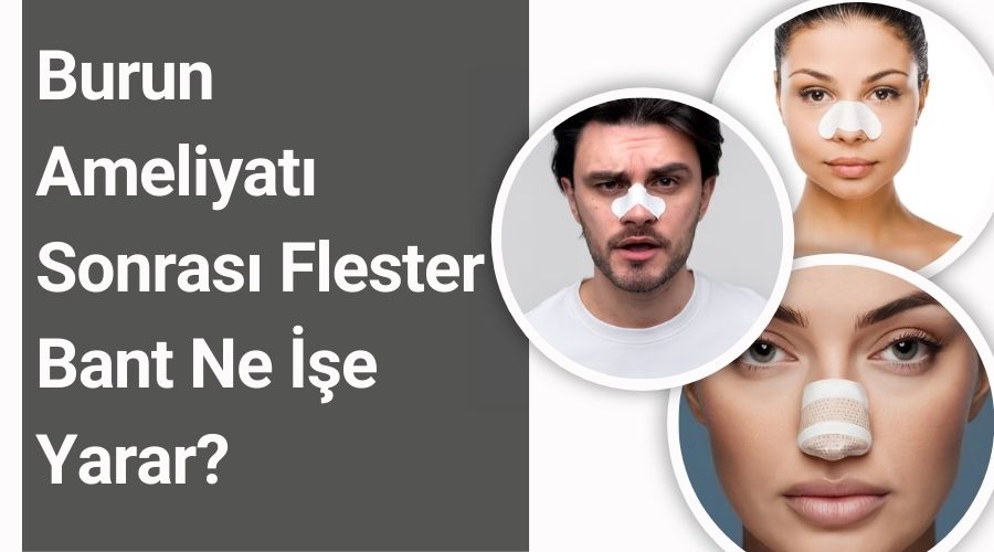 Burun Ameliyatı Sonrası Flester Bant Ne İşe Yarar? İstanbul